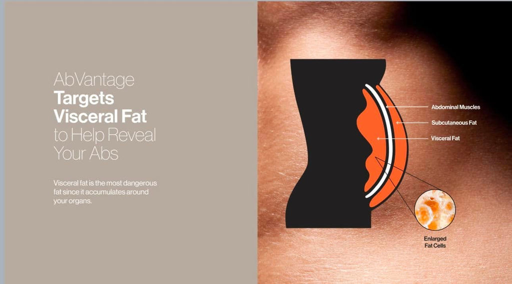 Slenderiiz+ AbVantage Weight Management Bundle