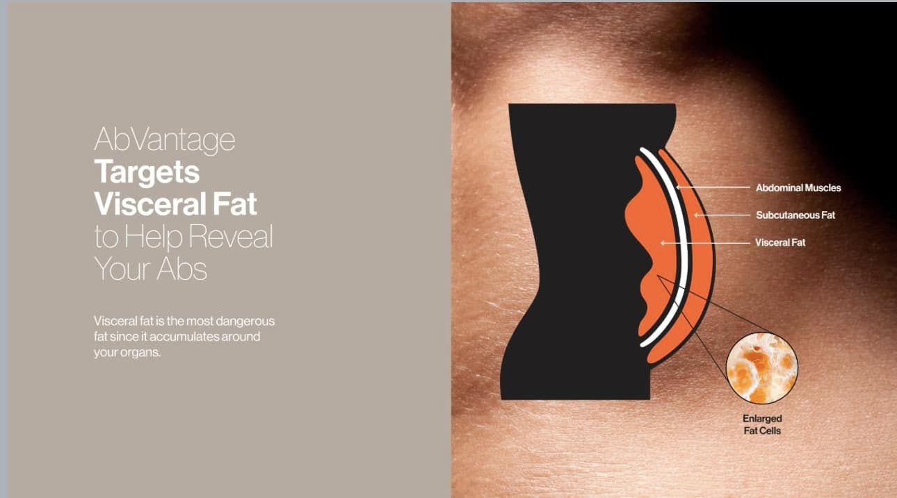 Slenderiiz+ AbVantage Weight Management Bundle